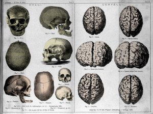 Les peaux et les cerveaux des hommes de génie. Étude de Cesare Lombroso (1835-1909), criminologue italien dans « L