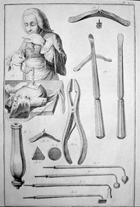 Trépanation du crâne, divers instruments (gravure) - Unknown artist