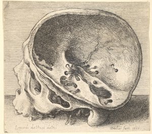 Crâne sectionné en profil à gauche avec le côté gauche du crâne enlevé, 1651 - Wenceslaus Hollar