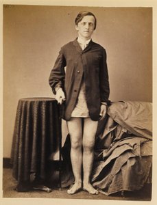 Soldat G. W. Warrington, guérison, sans amputation, après une fracture par balle de la rotule droite, extrait du catalogue photographique de la section de chirurgie