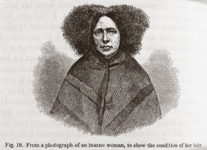 Psychiatrie Femme folle - Frederick (attr. to) Barnard