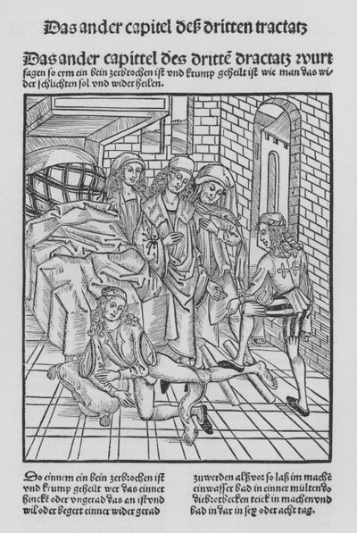 Le Livre de Chirurgie par Hieronymus Brunschwig - (after) German School