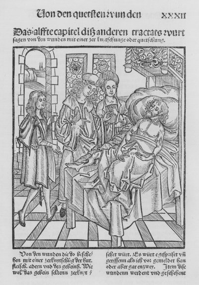 Le Livre de Chirurgie par Hieronymus Brunschwig - (after) German School