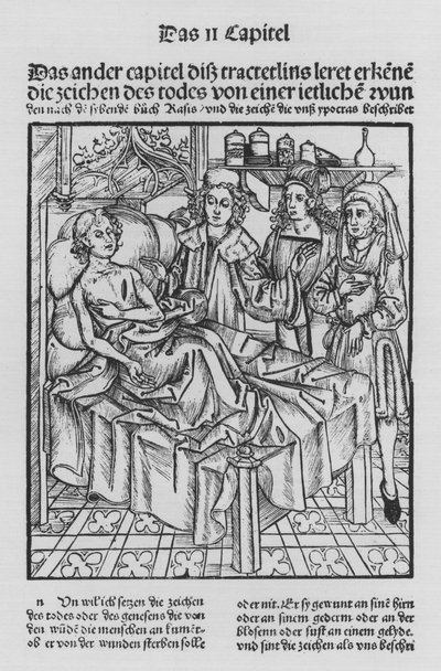 Le livre de Cirurgia par Hieronymus Brunschwig - (after) German School