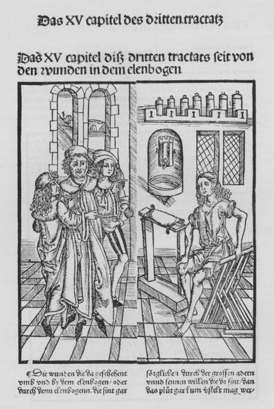 Le Livre de Cirurgia par Hieronymus Brunschwig - (after) German School