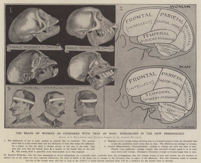 Le cerveau de la femme comparé à celui de l