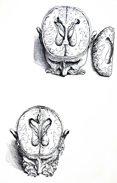 Les planches du septième livre de De Humani Corporis Fabrica - Andreas Vesalius