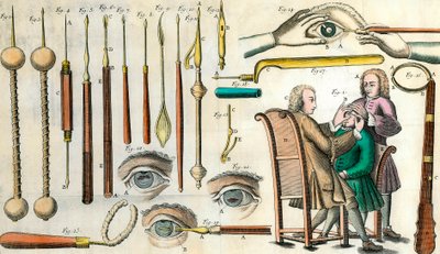 Chirurgie au 18e siècle : opération de l