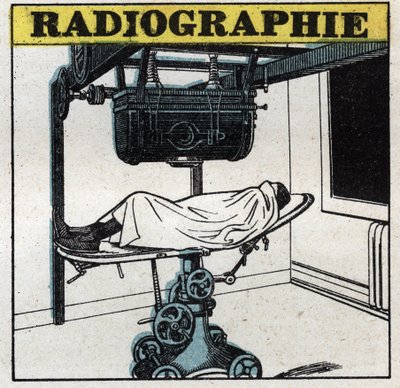 Rayons X : appareil à rayons X. Illustration anonyme de 1925. Collection privée. - Anonymous Anonymous