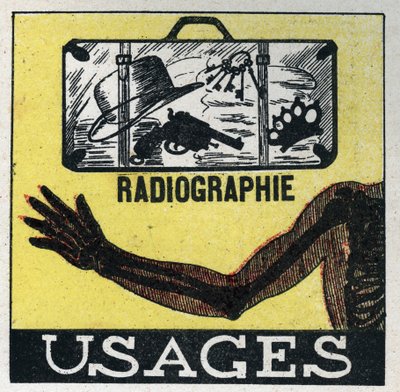 Rayons X : utilisation des rayons X pour voir à travers les objets et les corps. Illustration anonyme de 1925. Collection privée. - Anonymous Anonymous