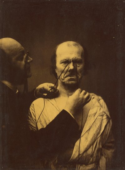 Agression, méchanceté, 1854-1856, imprimé 1862 - Duchenne de Boulogne