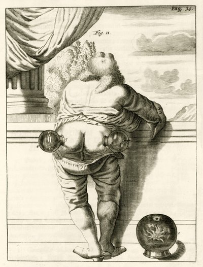 Un exemple de ventouses, de Exercitationes Practicae circa Medendi Methodum par Frederik Dekkers, 1694 - Dutch School