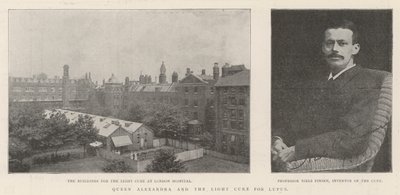 La reine Alexandra et le traitement par la lumière pour le lupus - English Photographer