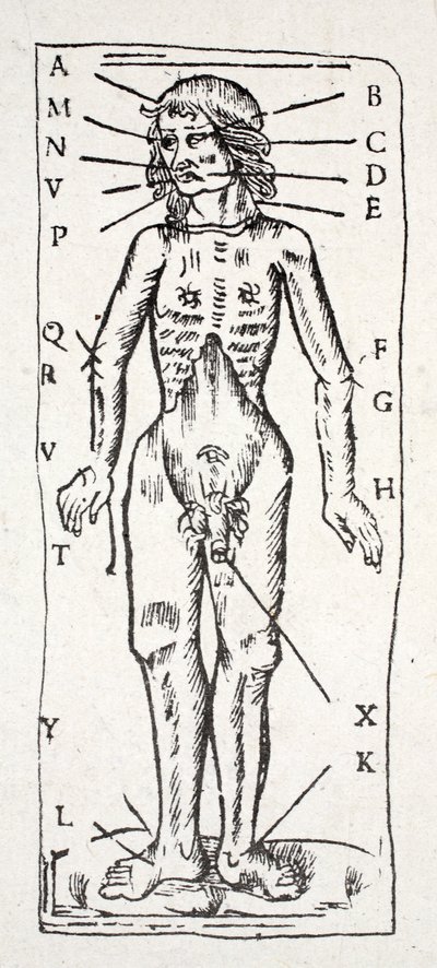Un corps qui a été sous le scalpel, avec des veines étiquetées - English School