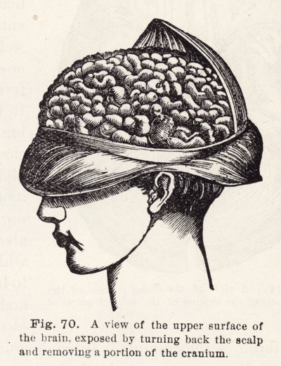 Vue de la surface supérieure du cerveau, exposée en retournant le cuir chevelu et en retirant une partie du crâne - English School
