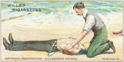 Respiration artificielle, méthode Sylvester - Position 2, no.17 de la série Premiers Secours des cartes de cigarettes Willss, 1913 - English School