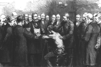 Traitement de la tuberculose par le Dr Koch à l