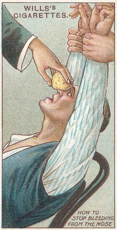 Comment arrêter le saignement du nez, no.31 de la série Premiers Secours des cartes de cigarettes Willss, 1913 - English School