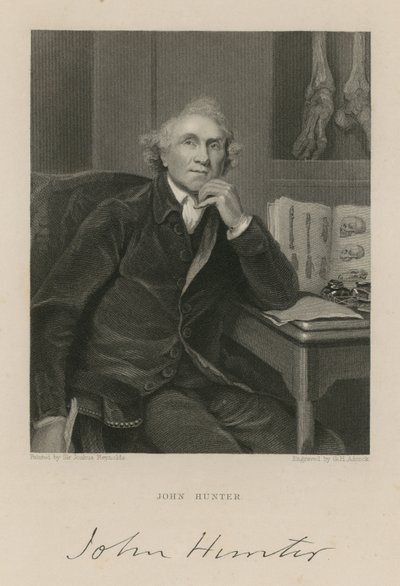 John Hunter - English School