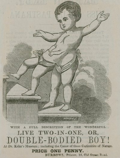 Vivre deux-en-un, ou garçon à double corps - English School