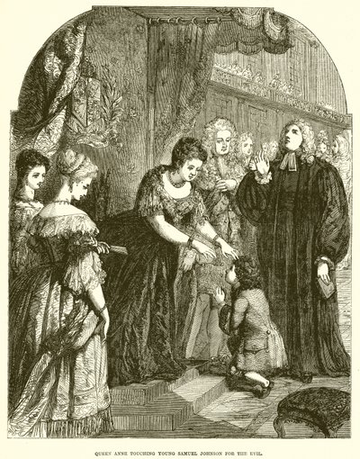 La reine Anne touchant le jeune Samuel Johnson pour le mal - English School