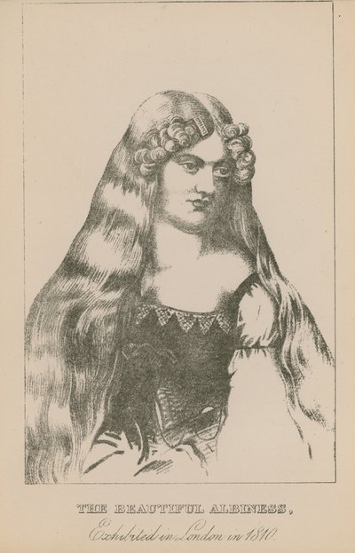 La belle albinos, exposée à Londres en 1810 - English School