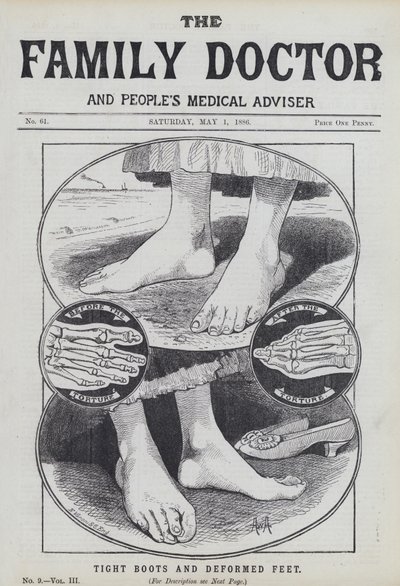 Bottes serrées et pieds déformés - English School