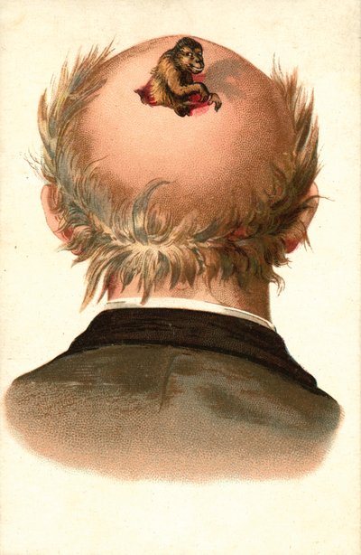 Tête d