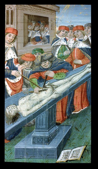 Dissection, de De Medina Fen I. II, par Avicenne - Flemish School