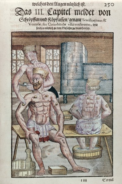 Ventouses, de Ophthalmodouleia par Georg Bartisch, publié à Dresde en 1583 - German School