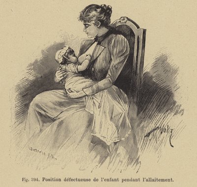 Position incorrecte d