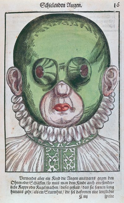 Masque pour traiter un strabisme, de l