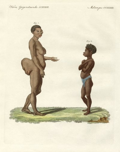 Variétés humaines étranges - German School