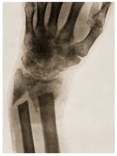 Radiographie d