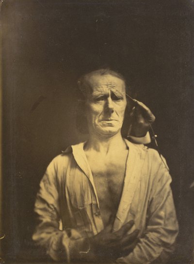 Spasme de m. corrugator supercilii sous une lumière très forte (à gauche) ; visage détendu (photographié en plein soleil) (à droite)
1854-1855, imprimé en 1862 (photo) - Guillaume-Benjamin-Armand Duchenne de Boulogne