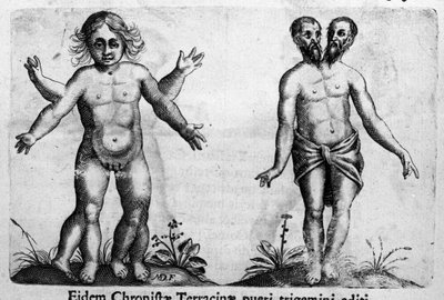 Différents types de monstres humains. Gravure tirée de « De monstrorum natura, causis et differentiis » par Fortunio Liceti (1577-1656), scientifique italien. 1646 - Italian School