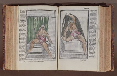 Anatomie féminine, de Commentaria cum amplissimis additionibus super anatomiam mundini, par Jacopo Berengario da Carpi, publié à Bologne, 1521 (gravure sur bois en couleur) - Italian School