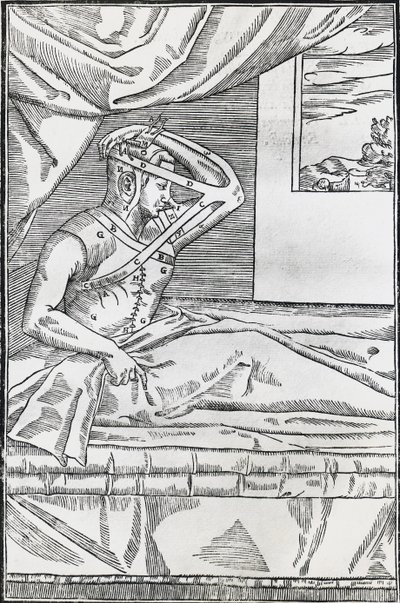 Chirurgie de rhinoplastie - Italian School