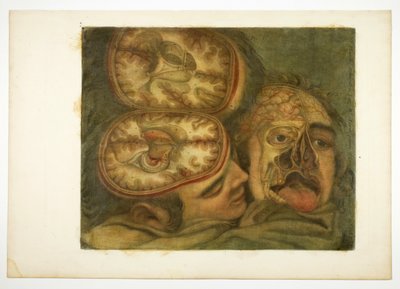 Dissection crânienne, planche cinq de l