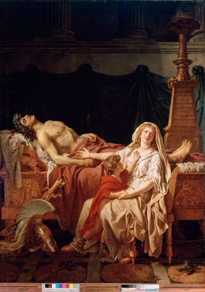 La douleur d