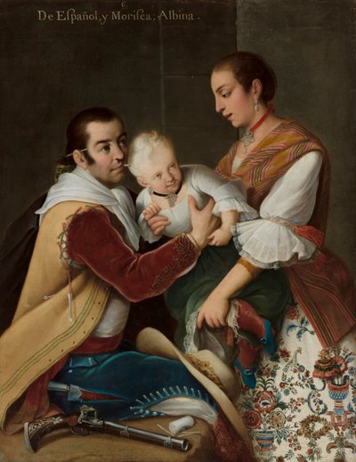 Fille albinos de l
