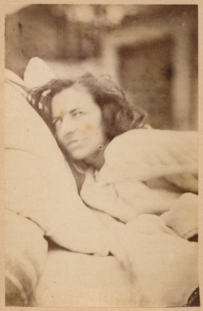 Épilepsie hystérique, délire, luxure, planche XXXVI de 