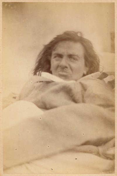 Épilepsie hystérique, hallucinations, répugnance, planche XXXV de 