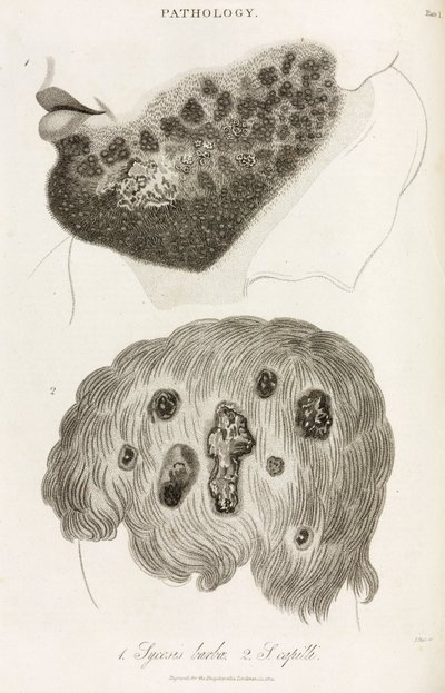 Dermatologie Maladies de la peau - John Pardon