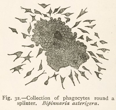 Dessin par Elie Metchnikoff de cellules phagocytaires entourant une particule étrangère - School Russian
