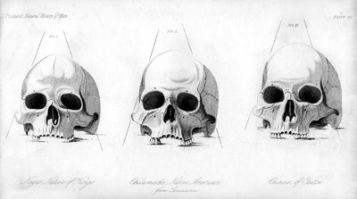 Trois types de crâne humain, 1848 - Unbekannt
