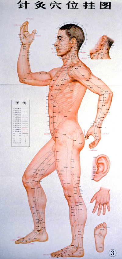 Acupuncture - Unknown Artist