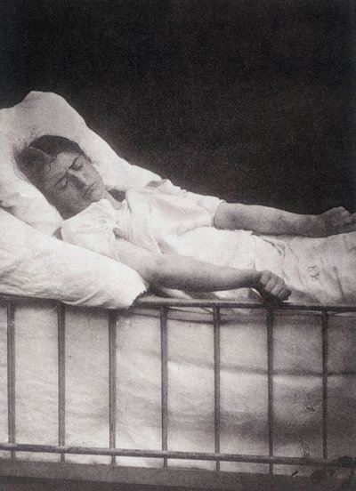 Hystéro-épilepsie - Attaque de tétanisme dans « Iconographie photographique de la Salpêtrière : service de M. Charcot » par Paul Regnard et Bourneville - Unknown artist