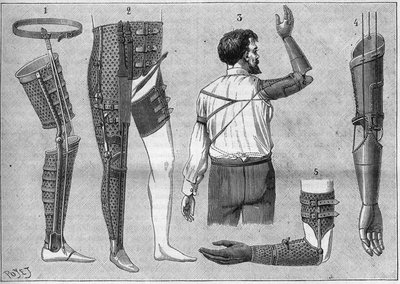 Appareils modernes pour amputés. 1) jambe artificielle avec ceinture, 2) appareil pour désarticuler la cuisse, 3 et 4 bras artificiels inventés et construits par M.L Matthieu pour le défunt Roger, 5) bras artificiel avec main, pouce et index. Dans "La natu - Unknown artist