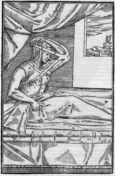 Chirurgie du nez : Chirurgie reconstructive du nez dans « De curtorum chirurgia per insitionem ». Venise - Unknown artist